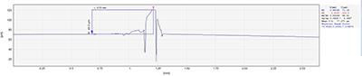 Convex hull detection of laser welding slag_byy688.com